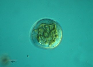Cianobacterias (Nostoc sp.), -- Fotógrafo: Antonio Guillén